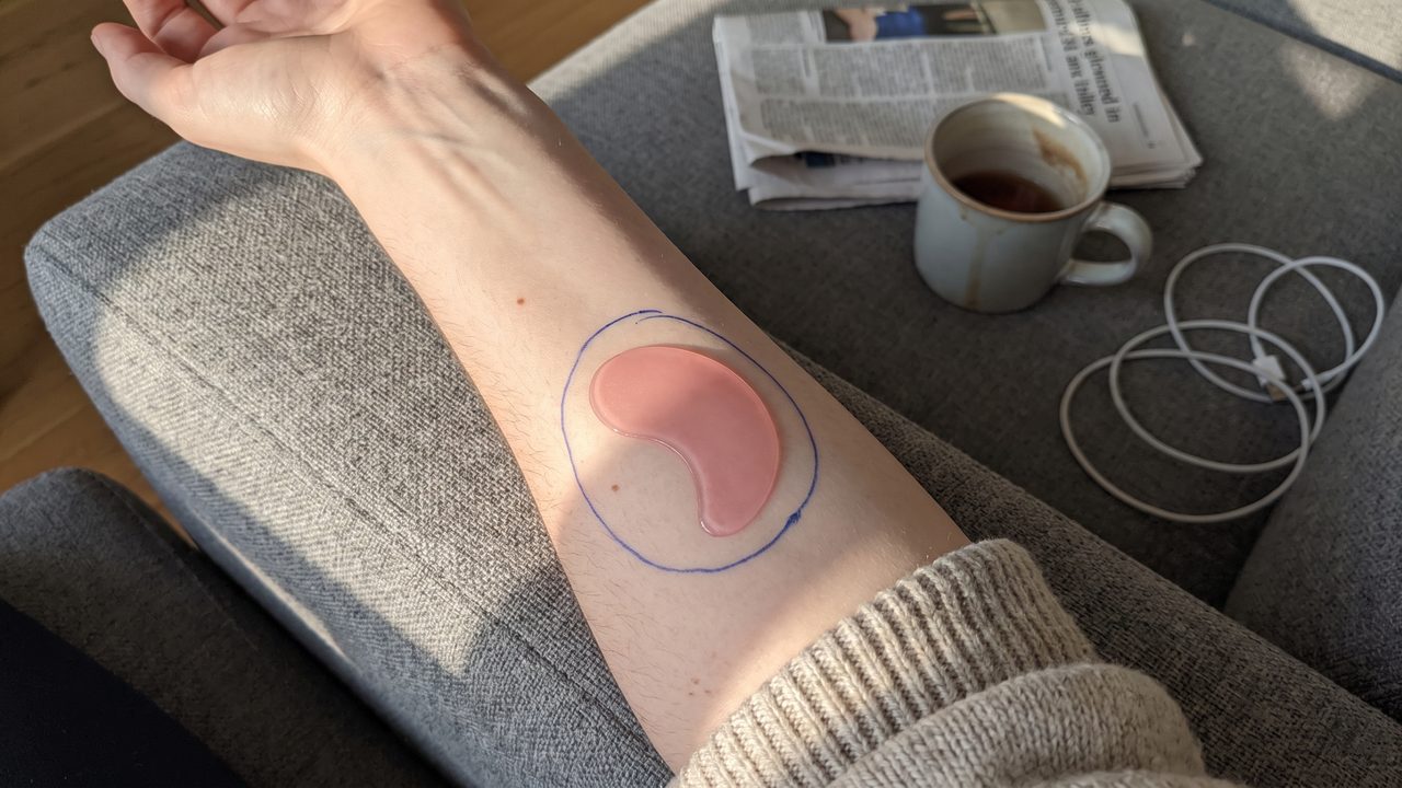 An inner forearm with a pink hydrogel patch stuck on and a ballpoint circle drawn around it, resting on a sofa armrest